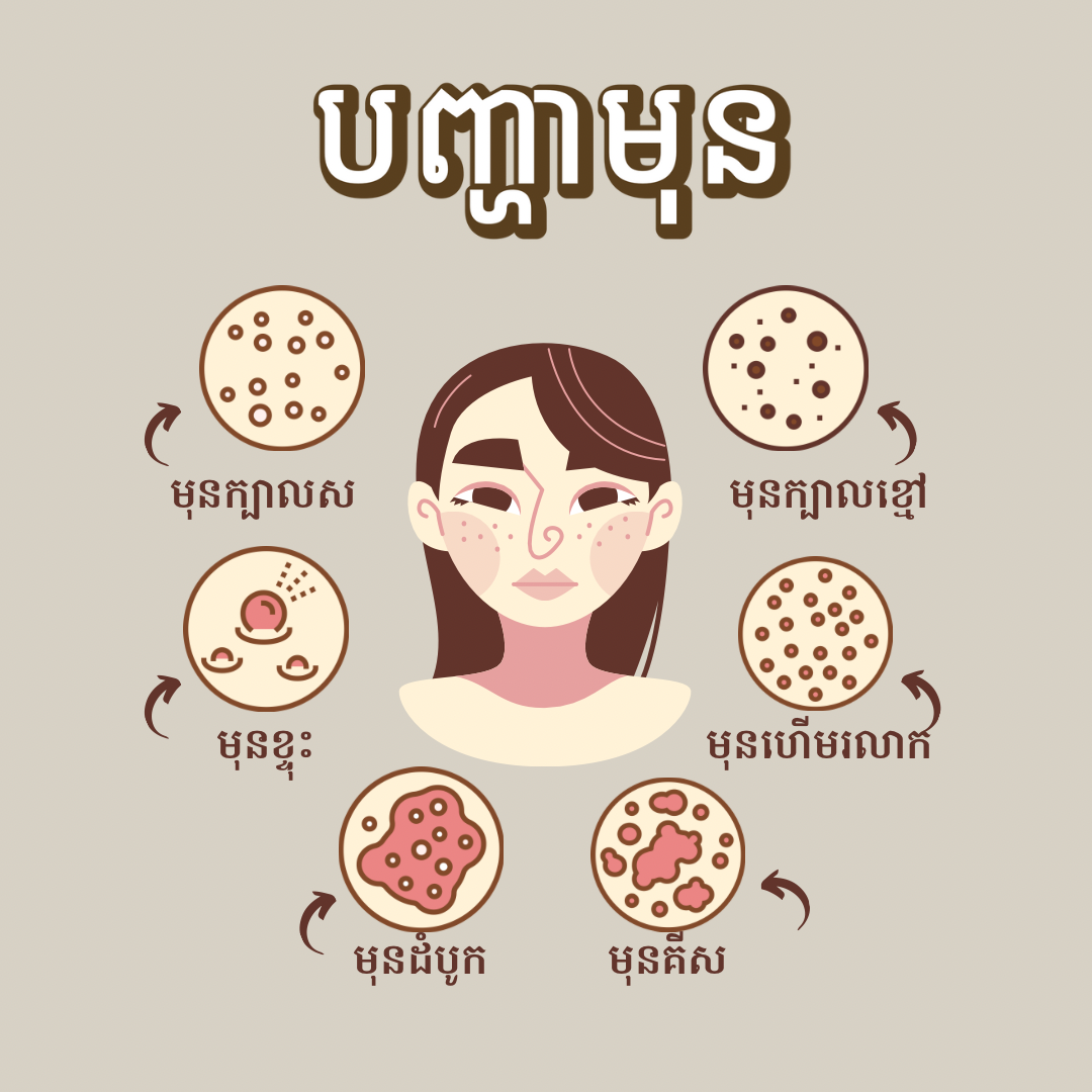 Acne Skin