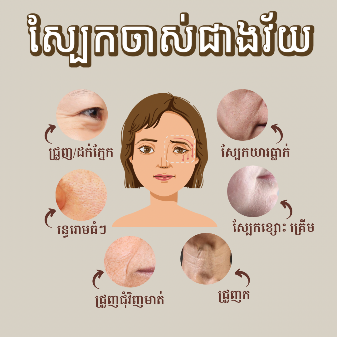 Aging Skin