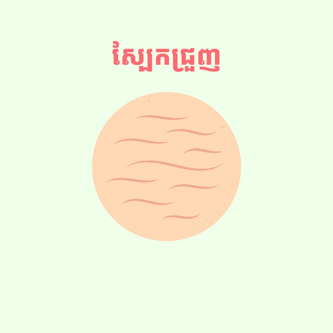 Fineline/Wrinkle
