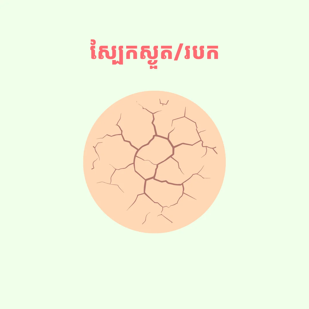 Dry/Flaky