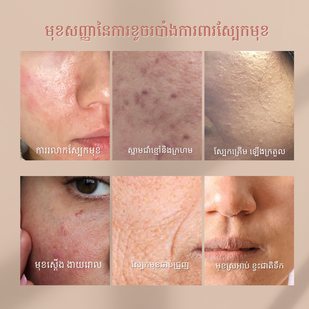 Broken Skin Barrier