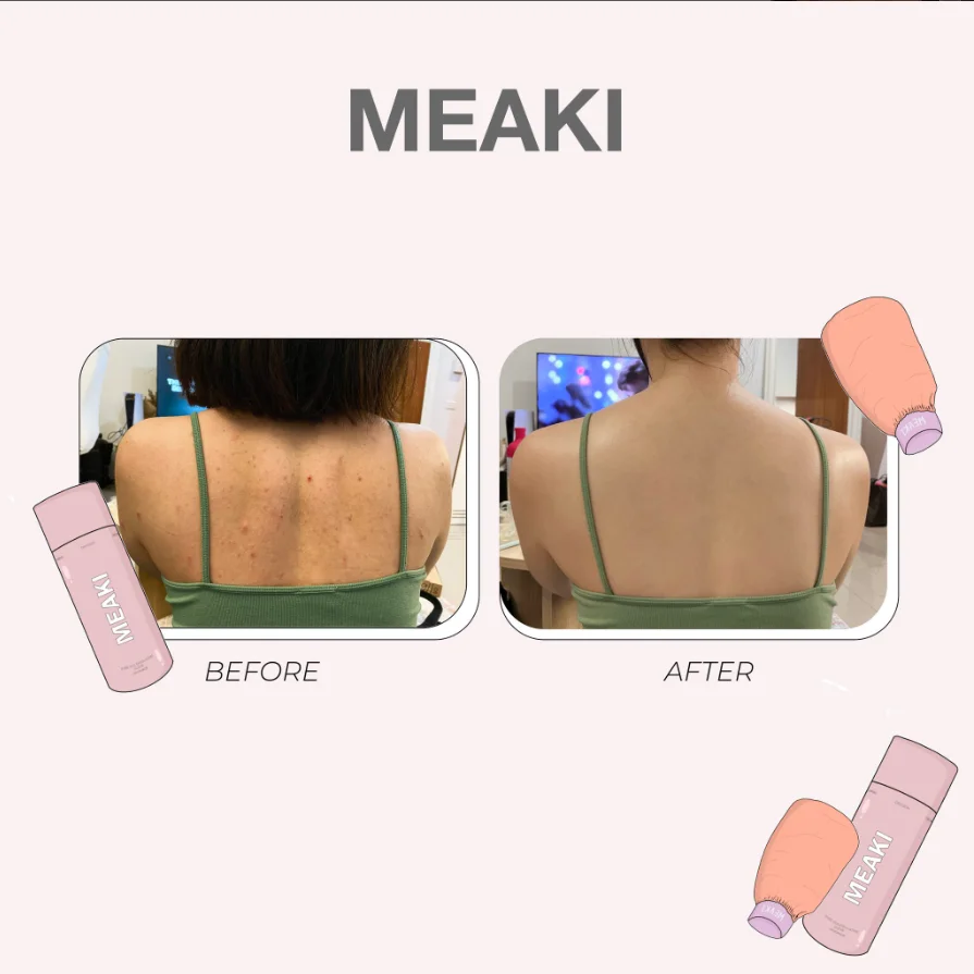 d6c94464-bc3a-4079-806f-0463c4d9a215.webp